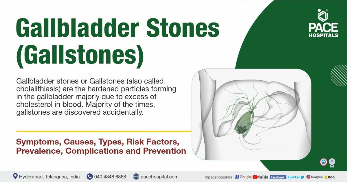 Gallstones deals natural treatment